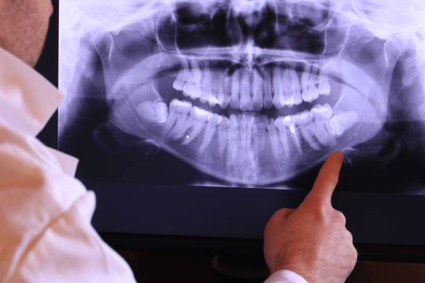 Best Broken or Chipped Tooth Repair in Bethel, OH